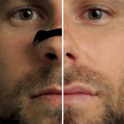 EaseAir™- Magnetic Breathing Nasal Strip